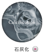 石灰化